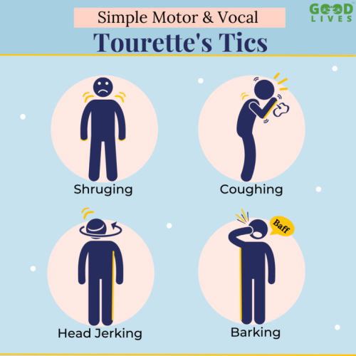 6 Doubts About Tourette Syndrome You Should Clarify 